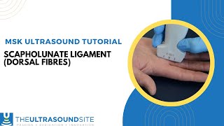 Ultrasound of the dorsal fibres of the Scapholunate ligament [upl. by Judus]