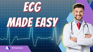 HIGH YIELD ECG Review for the USMLE AV Blocks [upl. by Larochelle]