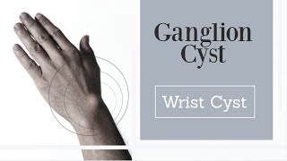 Wrist Ganglion Cyst [upl. by Anayaran609]