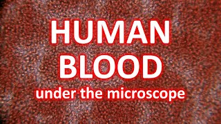 Human blood under the MICROSCOPE  invisible world [upl. by Darcie]