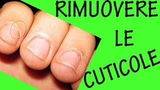 COME RIMUOVERE LE CUTICOLE Sos unghie 9 [upl. by Dieter]