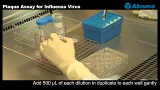 Plaque Assay for Influenza Virus [upl. by Titos56]