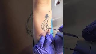 SCAR FREE TATTOO REMOVAL ep7 short [upl. by Annahael865]