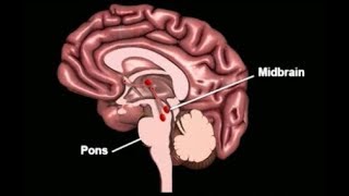 Sleep and Dreaming  Brain Anatomy Anatomy of the Human Brain [upl. by Englebert]