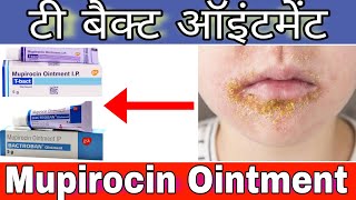 T bact ointment  Bactroban ointment  Mupirocin ointment uses dose sideeffects  T bact use [upl. by Vassaux]