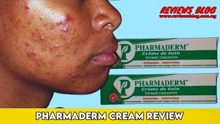 Pharmaderm Cream Review Watch This Video Before You Buy It [upl. by Halima]