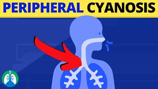 Peripheral Cyanosis Medical Definition  Quick Explainer Video [upl. by Irret]