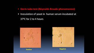 Microbiology Opportunistic infections 2nd mbbs [upl. by Katrine]