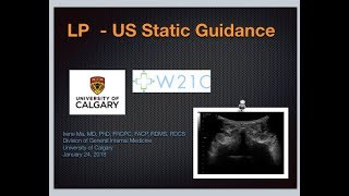 US guided LP  static guidance [upl. by Ettennan919]