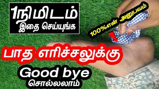 1நிமிடத்தில் பாத எரிச்சல் காணமல் போக இதை செயுங்க  patha erichal treatment in tamil [upl. by Towland]