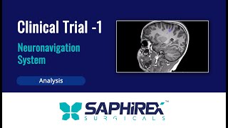 Clinical Trial  1 Neuronavigation System [upl. by Saloma]