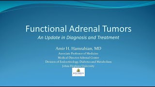 Functional Adrenal Tumors An Update in Diagnosis and Treatment [upl. by Mureil]