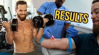 Carnivore Diet Results 6 Months Bloodwork with Saladino [upl. by Kendyl]