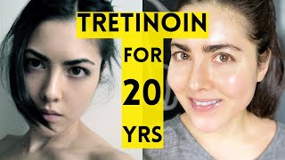 20 Year Results of Using Tretinoin [upl. by Daren]