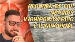 Bloqueo de nervios Iliohipogástrico e Ilioinguinal guiados por ultrasonido [upl. by Shell]