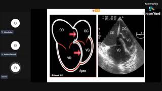 meilleure explication de🤩 Embolie pulmonaire🤩Pr FOUAD cardiologie pneumologie résidanat EVC ECN [upl. by Matthus]