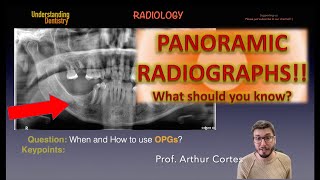 Extraoral Radiographs TUTORIAL Dental Panoramic OPG reading review Dentistry students Radiology [upl. by Irvin824]