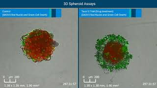 Monitoring and Quantifying 3D Tumor Spheroid Drug Cytotox by RTCA eSight Live Cell Analysis System [upl. by Neyugn]