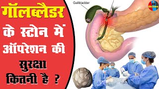 Laparoscopy  Kidney StoneGallbladder Surgery गॉलब्लैडर के स्टोन में ऑपरेशनgallbladderstone [upl. by Eelan]