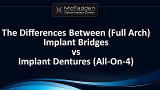 Implant Bridges vs Implant Dentures AllOn4 [upl. by Yffub712]