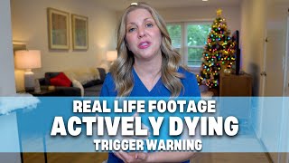 Actively Dying Breathing Real Life Footage Trigger Warning [upl. by Eelynnhoj]