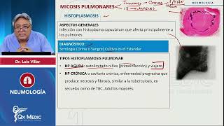 2024 NEUMOLOGÍA Micosis pulmonares Histoplasmosis [upl. by Ratha228]