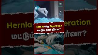 Herniaக்கு Operation மட்டும் தான் தீர்வா  Treatment for Hernia [upl. by Thorstein346]