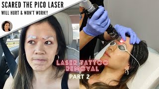 How I got my microblading removed Before amp AfterPart 2 [upl. by Mathre182]