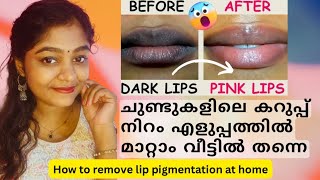 💋ചുണ്ടുകളിലെ darknessamp pigmentation ഇനി വീട്ടിൽ തന്നെ മാറ്റിയെടുക്കാംHome Remedies darklipsremedy [upl. by Berkley]