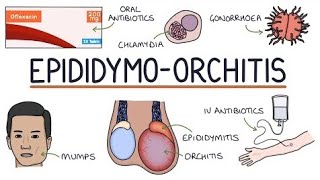 EpididymoOrchitis  epididymis [upl. by Isolde719]