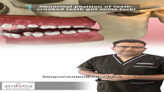 Why Do Teeth Grow Crooked And How to Fix Them [upl. by Lidda]