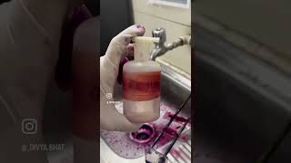 Afb stain  sputum test  test for tb  mycobacterium tuberculosis test [upl. by Henke]