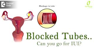 Is IUI Possible with blocked tubes  Fallopian Tube Blockage  Dr Uma Maheshwari of C9 Hospitals [upl. by Suolkcin8]