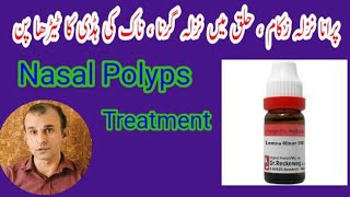 Nasal Polyps Treatment  Lemna Minor 30 [upl. by Ahsinej]