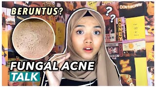 JERAWAT TAPI BUKAN JERAWAT   Fungal Acne Talk [upl. by Washburn]