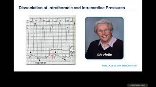 ASE 2021 Echo evaluation of Pericardial diseases Constrictive vs Restrictive [upl. by Saunder]