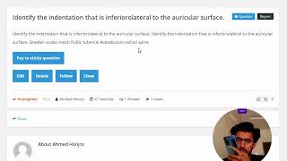 Identify the indentation that is inferior lateral to the auricular surface [upl. by Whallon]