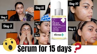 The Derma Co 2 Kojic Acid Face Serum  Treats Hyper Pigmentation  Dark Spots amp Blemishes JAHNABI [upl. by Liliane]