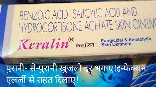 पुराने से पुराने खुजली त्वचा रोग को खत्म करें Keralin Ointment use in psoriasis And Fungicidal [upl. by Ethelind72]