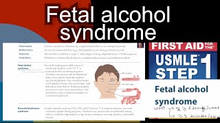 Fetal alcohol syndrome  small palpebral fissure smooth philtrum amp thin vermillion border by step 1 [upl. by Parsifal]