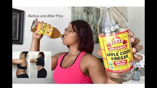 Drinking Apple Cider Vinegar  Lose weight FAST [upl. by Esirehc]