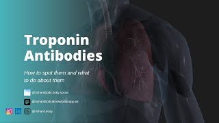 Whats a Macro Troponin and what should I do about it [upl. by Opportina]