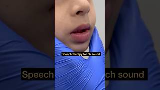 Speech Therapy  Articulation ch Sound  Tongue Positioning  Mis articulation  Teach Sound [upl. by Elyl]