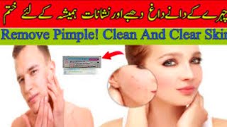 Fasoderm  f gel uses l best to remove acne amp pimple from skin l full review by aneespharmacist [upl. by Ohara]