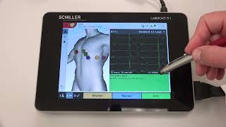 El ECG más fácil de usar  CARDIOVIT FT1 ecg electrocardiógrafo [upl. by Nnaeirb]