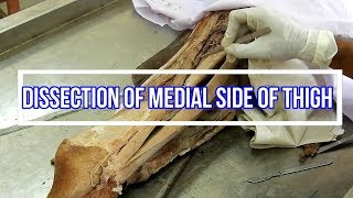 Dissection of Medial Side of Thigh [upl. by Aniles]