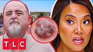 Dr Lee Thinks This Patients Pimple Could Be SKIN CANCER  Dr Pimple Popper [upl. by Acirderf]