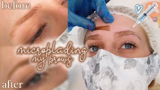 getting my eyebrows microbladed my experience amp results 💉 [upl. by Oninotna]