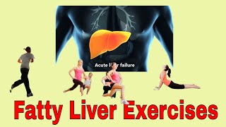 Fatty Liver Exercises [upl. by Peisch458]