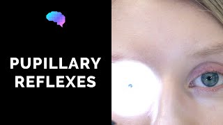 Pupillary Reflexes  OSCE Guide Clip  UKMLA  CPSA [upl. by Nixon]